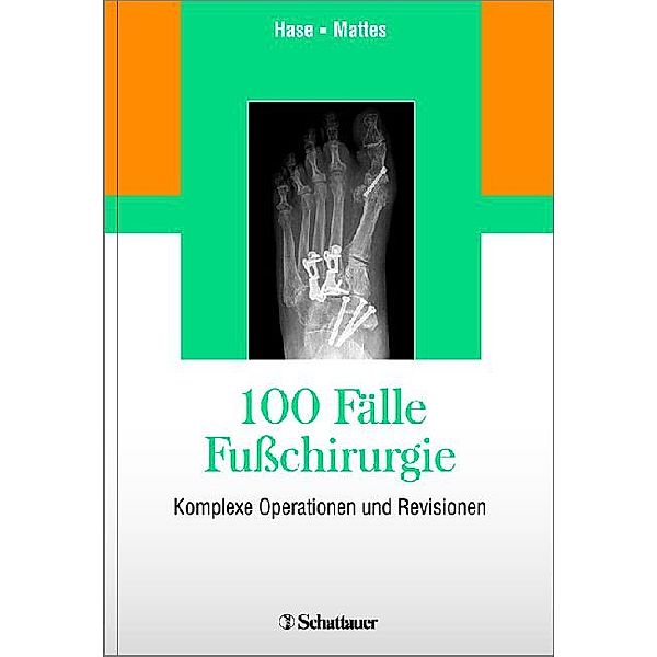 100 Fälle Fußchirurgie