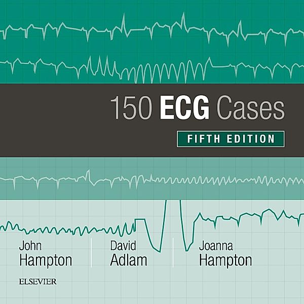 150 ECG Cases, John Hampton, David Adlam, Joanna Hampton