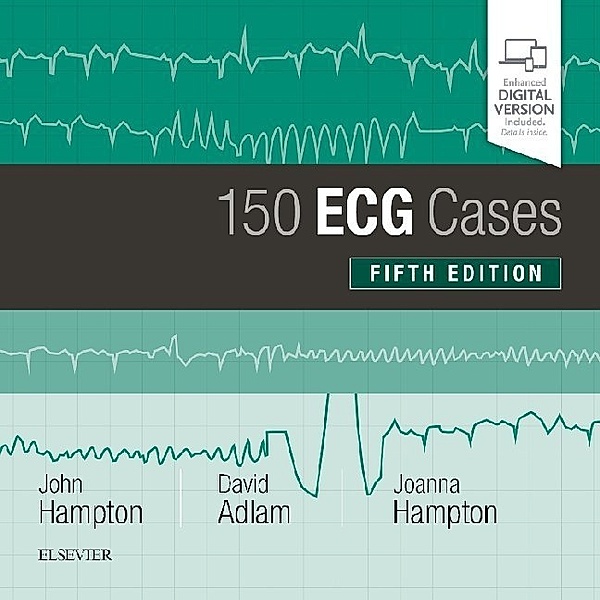 150 ECG Cases, John Hampton, David Adlam, Joanna Hampton