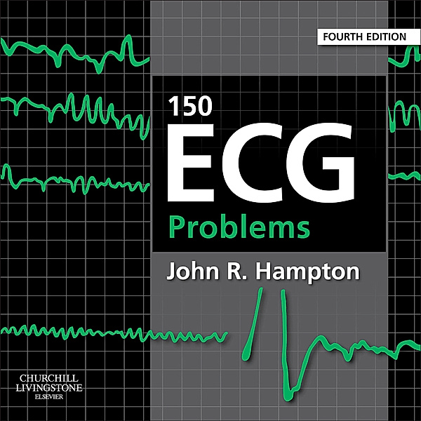150 ECG Problems E-Book, John Hampton