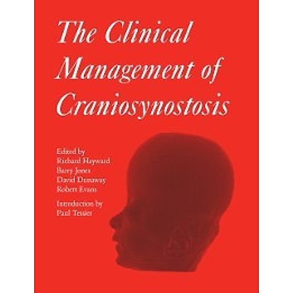 163: Clinical Management of Craniosynostosis, Barry Jones, Richard Hayward, David Dunaway