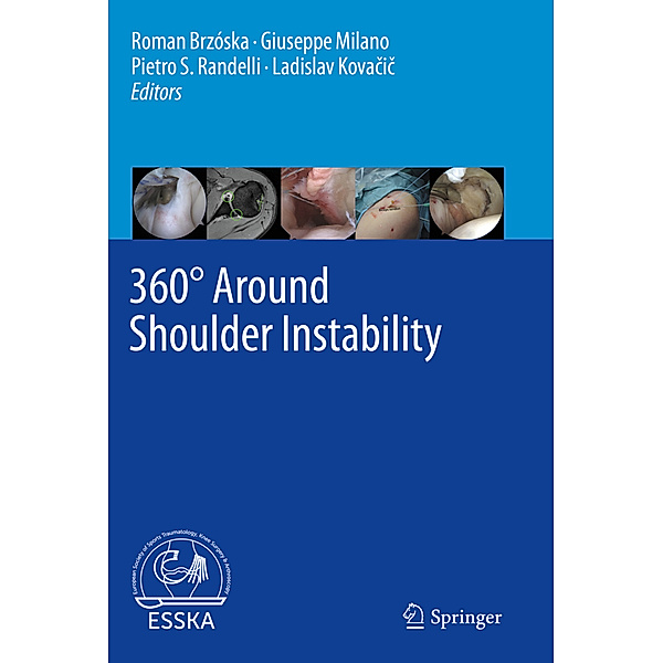 360° Around Shoulder Instability