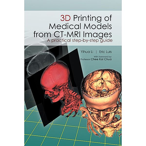 3D Printing of Medical Models  from Ct-Mri Images, Eric Luis, Yihua Li
