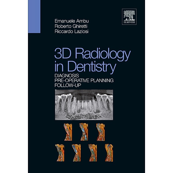 3D Radiology in Dentistry, Emanuele Ambu, Roberto Ghiretti, Riccardo Laziosi