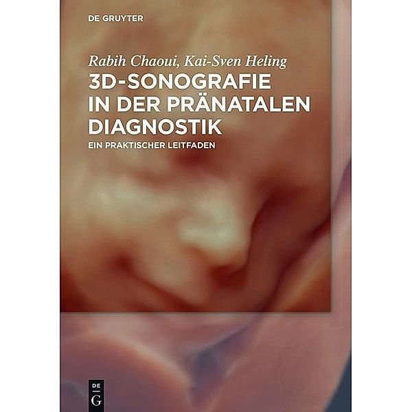 3D-Sonografie in der pränatalen Diagnostik, Rabih Chaoui, Kai-Sven Heling