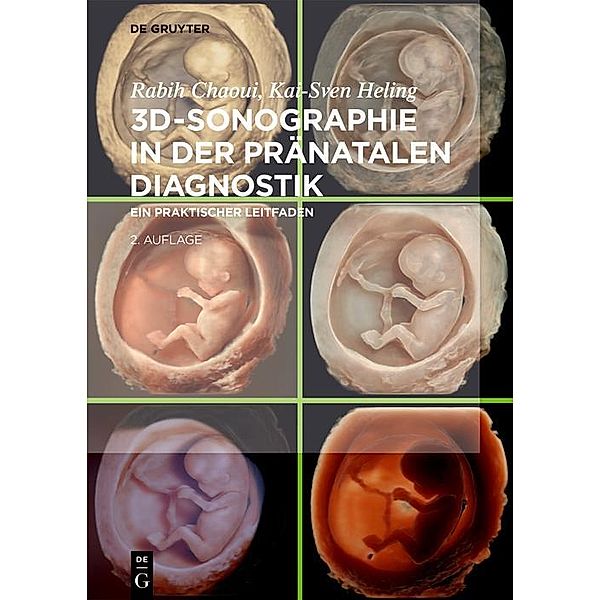 3D-Sonographie in der pränatalen Diagnostik, Rabih Chaoui, Kai-Sven Heling