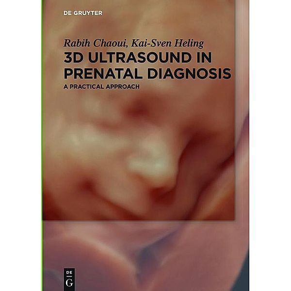 3D Ultrasound in Prenatal Diagnosis, Rabih Chaoui, Kai-Sven Heling