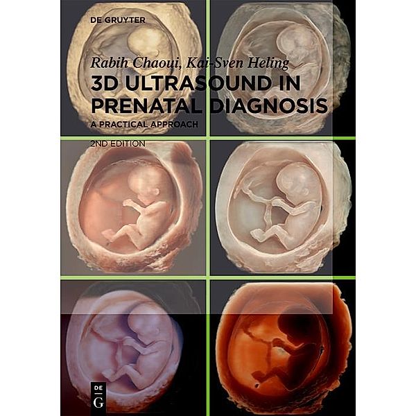 3D Ultrasound in Prenatal Diagnosis, Rabih Chaoui, Kai-Sven Heling