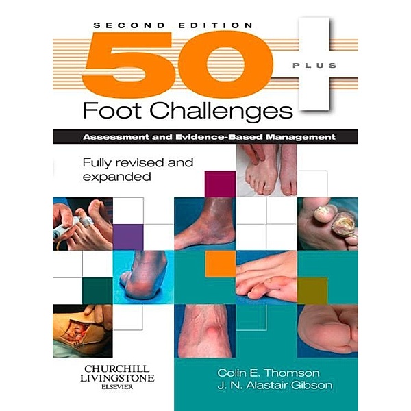 50+ Foot Challenges, Colin Thomson, J. N. Alastair Gibson