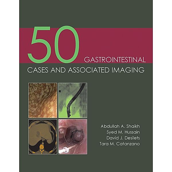 50 Gastrointestinal Cases and Associated Imaging, Abdullah A. Shaikh