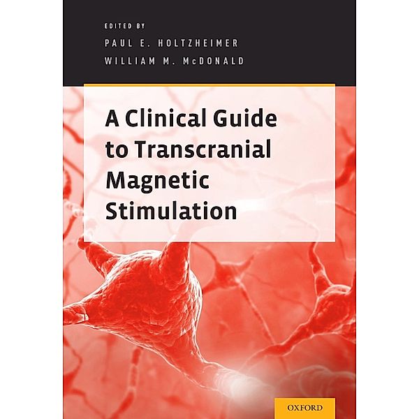 A Clinical Guide to Transcranial Magnetic Stimulation