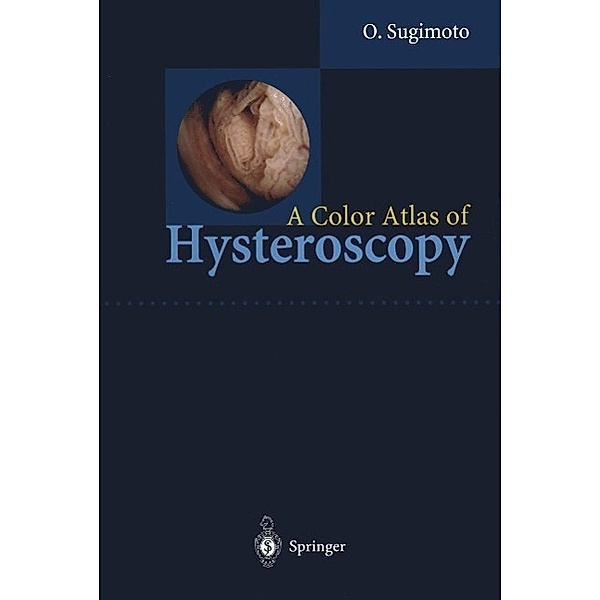 A Color Atlas of Hysteroscopy, Osamu Sugimoto