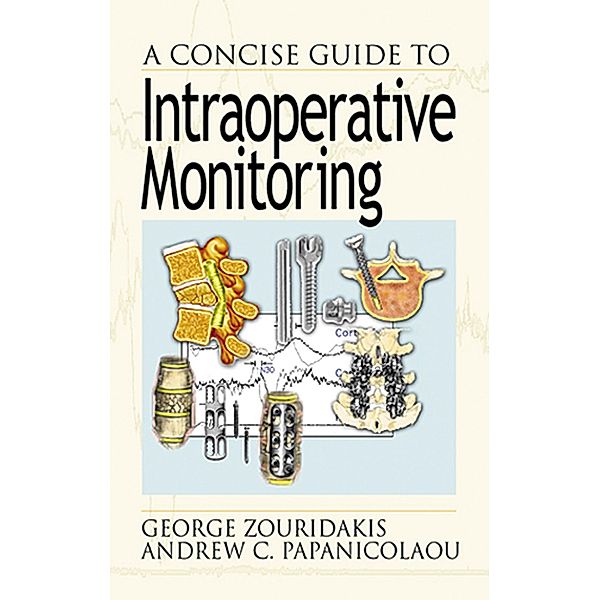 A Concise Guide to Intraoperative Monitoring, George Zouridakis, Andrew C. Papanicolaou