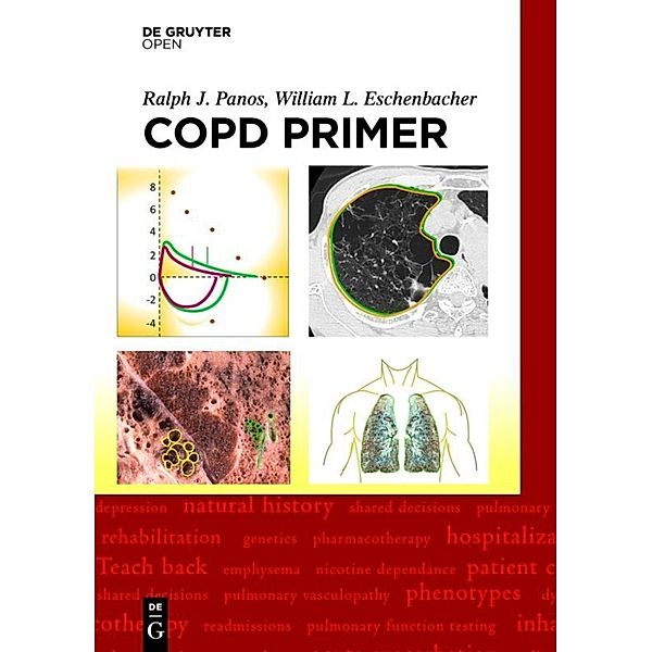 A COPD Primer, Ralph Panos, William Eschenbacher