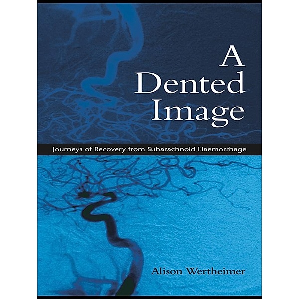A Dented Image, Alison Wertheimer