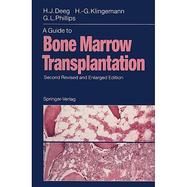 A Guide to Bone Marrow Transplantation, H. Joachim Deeg, Hans-Georg Klingemann, Gordon L. Phillips