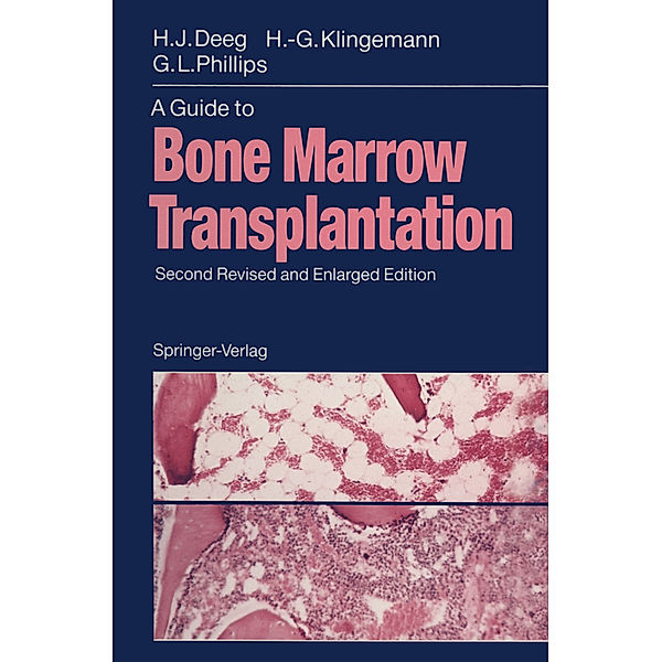 A Guide to Bone Marrow Transplantation, H.Joachim Deeg, Hans-Georg Klingemann, Gordon L. Phillips