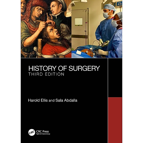 A History of Surgery, Harold Ellis, Sala Abdalla