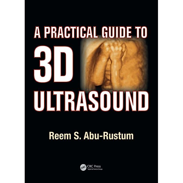 A Practical Guide to 3D Ultrasound, Reem S. Abu-Rustum