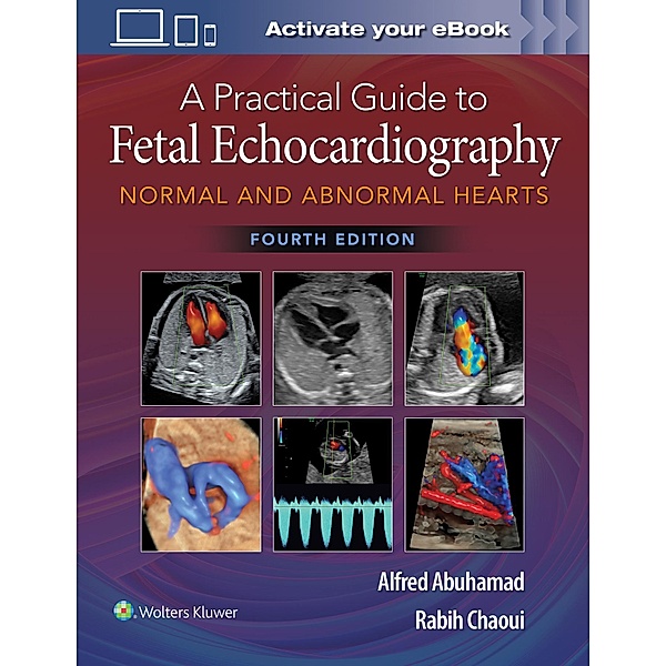 A Practical Guide to Fetal Echocardiography, Alfred Z. Abuhamad, Rabih Chaoui