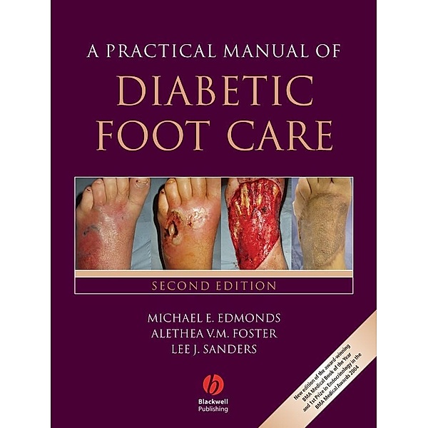 A Practical Manual of Diabetic Foot Care, Michael E. Edmonds, Alethea V. M. Foster, Lee Sanders