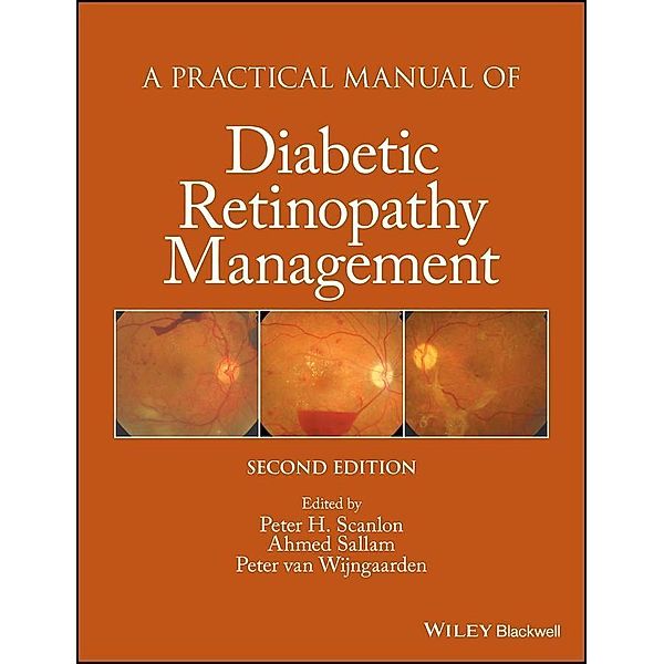 A Practical Manual of Diabetic Retinopathy Management / Practical Manual of Series