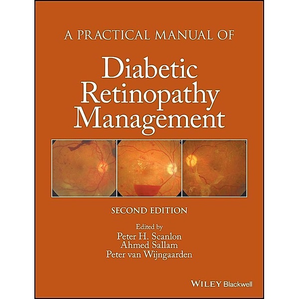 A Practical Manual of Diabetic Retinopathy Management / Practical Manual of Series