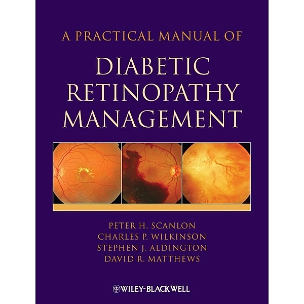 A Practical Manual of Diabetic Retinopathy Management, Peter H. Scanlon, Stephen Aldington, Charles Wilkinson, David Matthews