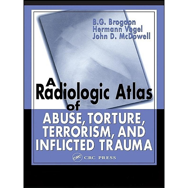 A Radiologic Atlas of Abuse, Torture, Terrorism, and Inflicted Trauma, B. G. Brogdon, Hermann Vogel, John D. McDowell