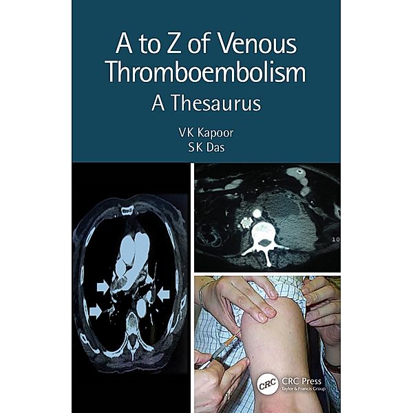 A to Z of Venous Thromboembolism, Vk Kapoor, Sk Das