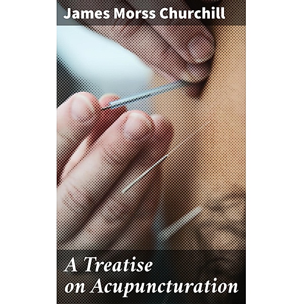A Treatise on Acupuncturation, James Morss Churchill