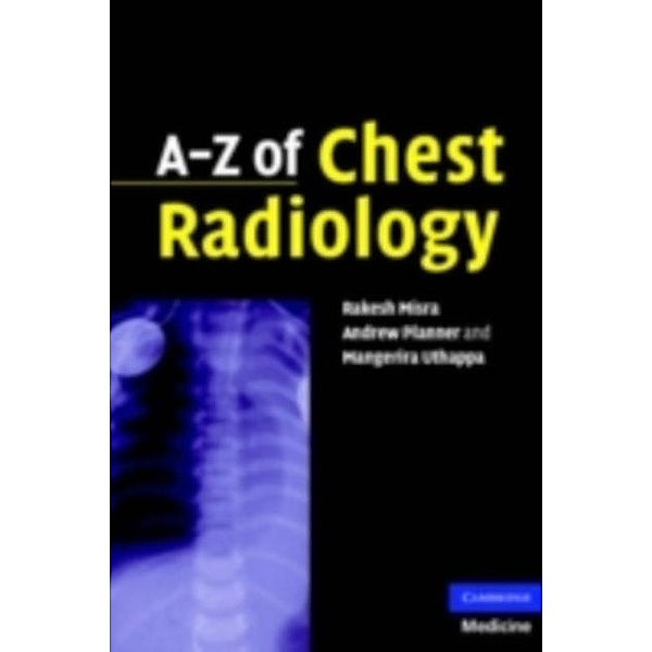 A-Z of Chest Radiology, Andrew Planner