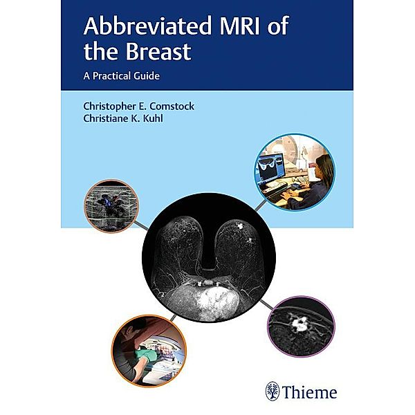 Abbreviated MRI of the Breast, Christopher E. Comstock, Christiane Kuhl
