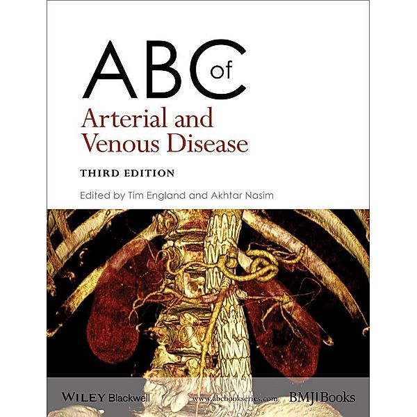 ABC of Arterial and Venous Disease / ABC Series