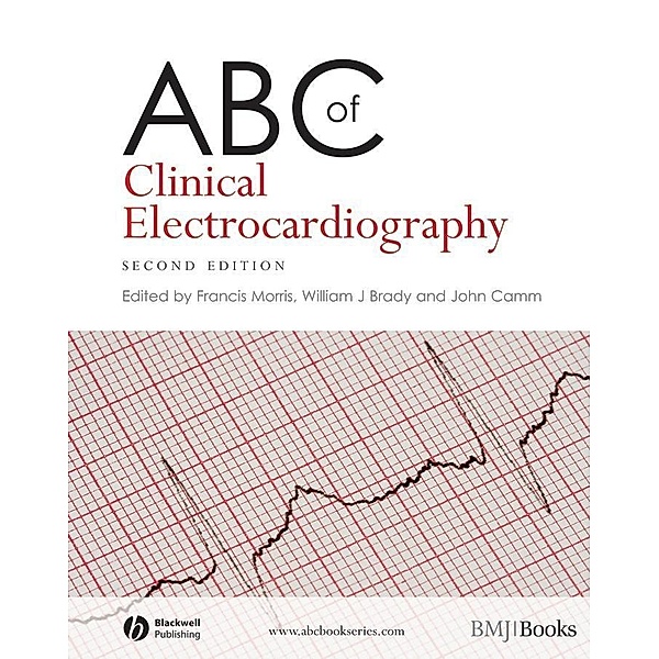 ABC of Clinical Electrocardiography / ABC Series