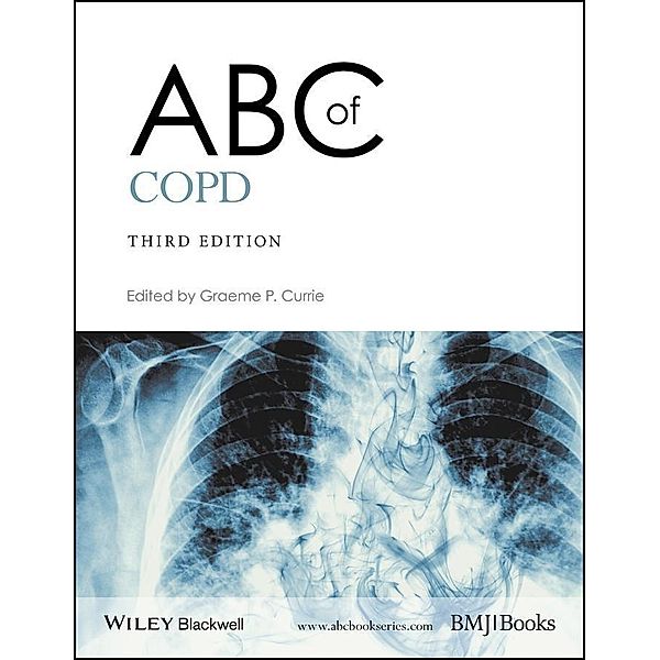ABC of COPD / ABC Series