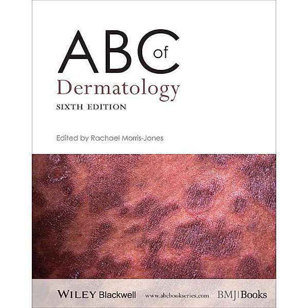 ABC of Dermatology / ABC Series