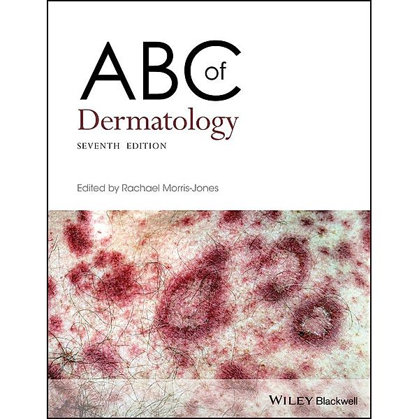 ABC of Dermatology / ABC Series