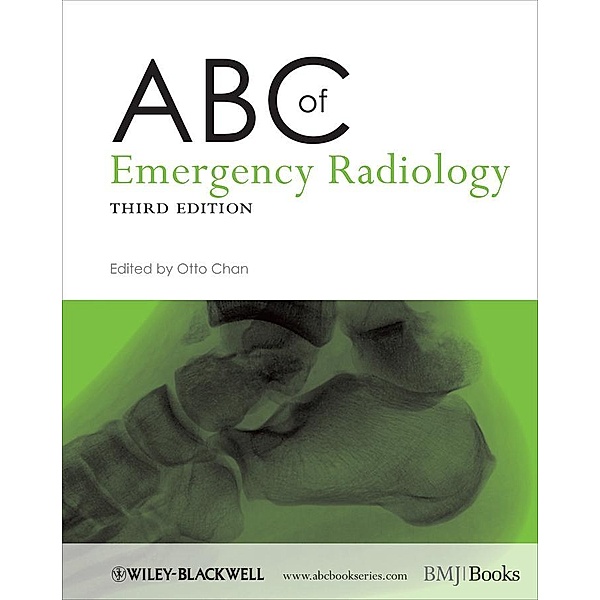 ABC of Emergency Radiology / ABC Series