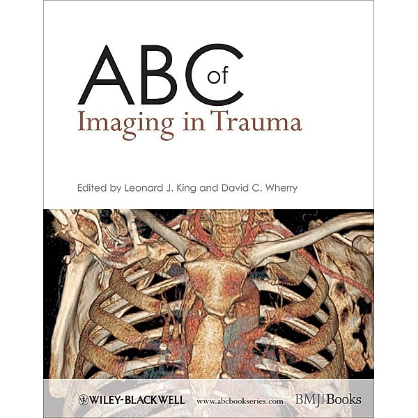 ABC of Imaging in Trauma / ABC Series
