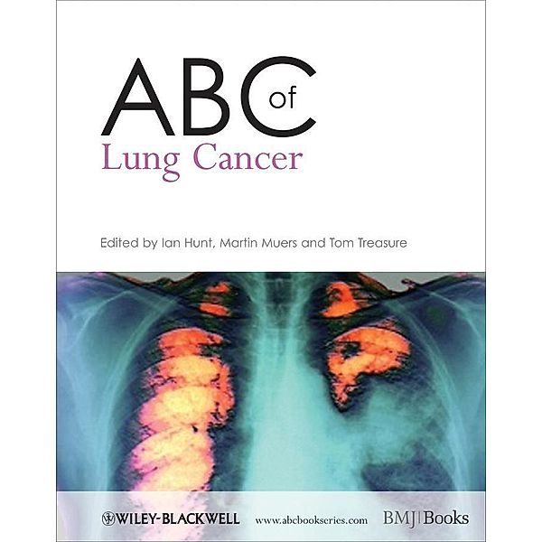 ABC of Lung Cancer / ABC Series