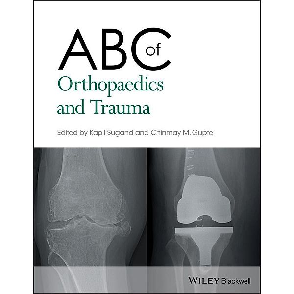 ABC of Orthopaedics and Trauma / ABC Series