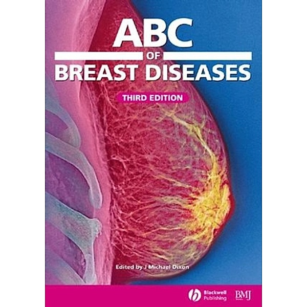 ABC Series: ABC of Breast Diseases