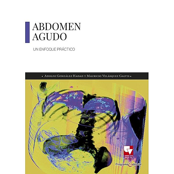 Abdomen agudo / Salud, Adolfo González H