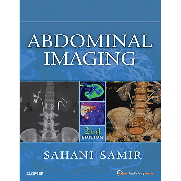 Abdominal Imaging E-Book, Dushyant V Sahani, Anthony E Samir