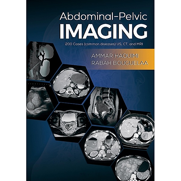 Abdominal-Pelvic Imaging / Austin Macauley Publishers, Ammar Haouimi