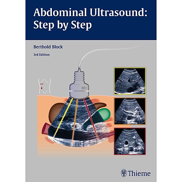 Abdominal Ultrasound: Step by Step, Berthold Block