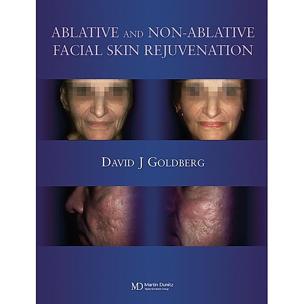Ablative and Non-ablative Facial Skin Rejuvenation, David J. Goldberg