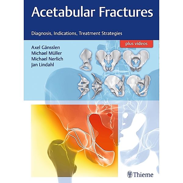 Acetabular Fractures, Axel Gänsslen, Michael Müller, Michael Nerlich