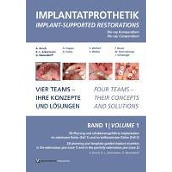 Ackermann, K: Blu-Ray-Kompendium Implantatprothetik 1, Karl-Ludwig Ackermann, Axel Kirsch, Gerhard Neuendorff